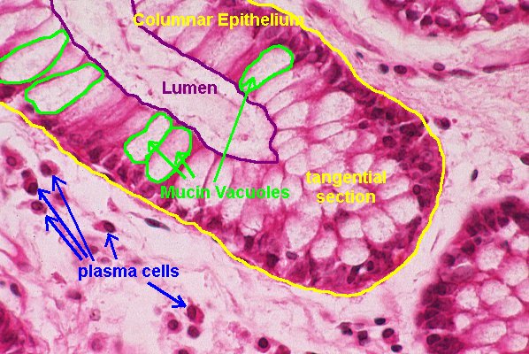 Plasma Cell Histology