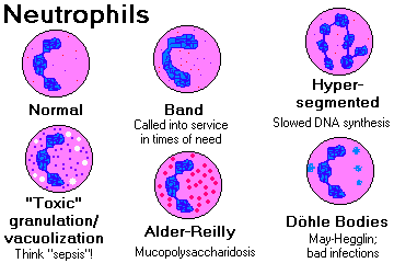Hypogranular Neutrophils