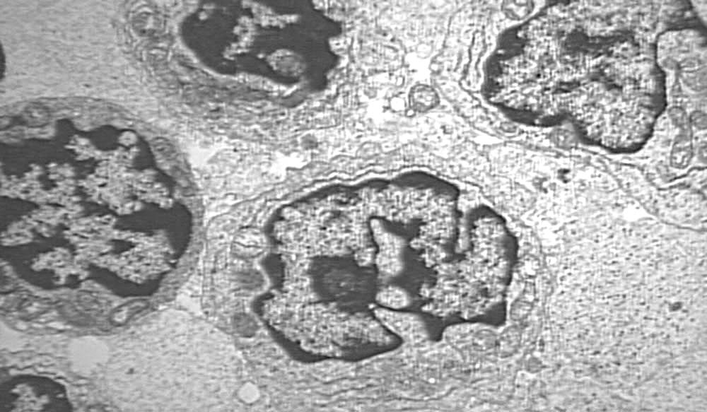 Animal Cell Electron Micrograph. {09040} electron micrograph of